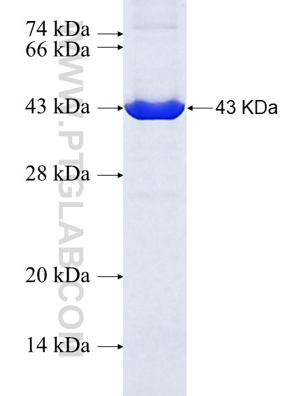 C6orf81 fusion protein Ag37017 SDS-PAGE C6orf81 fusion protein Ag37017 SDS-PAGE