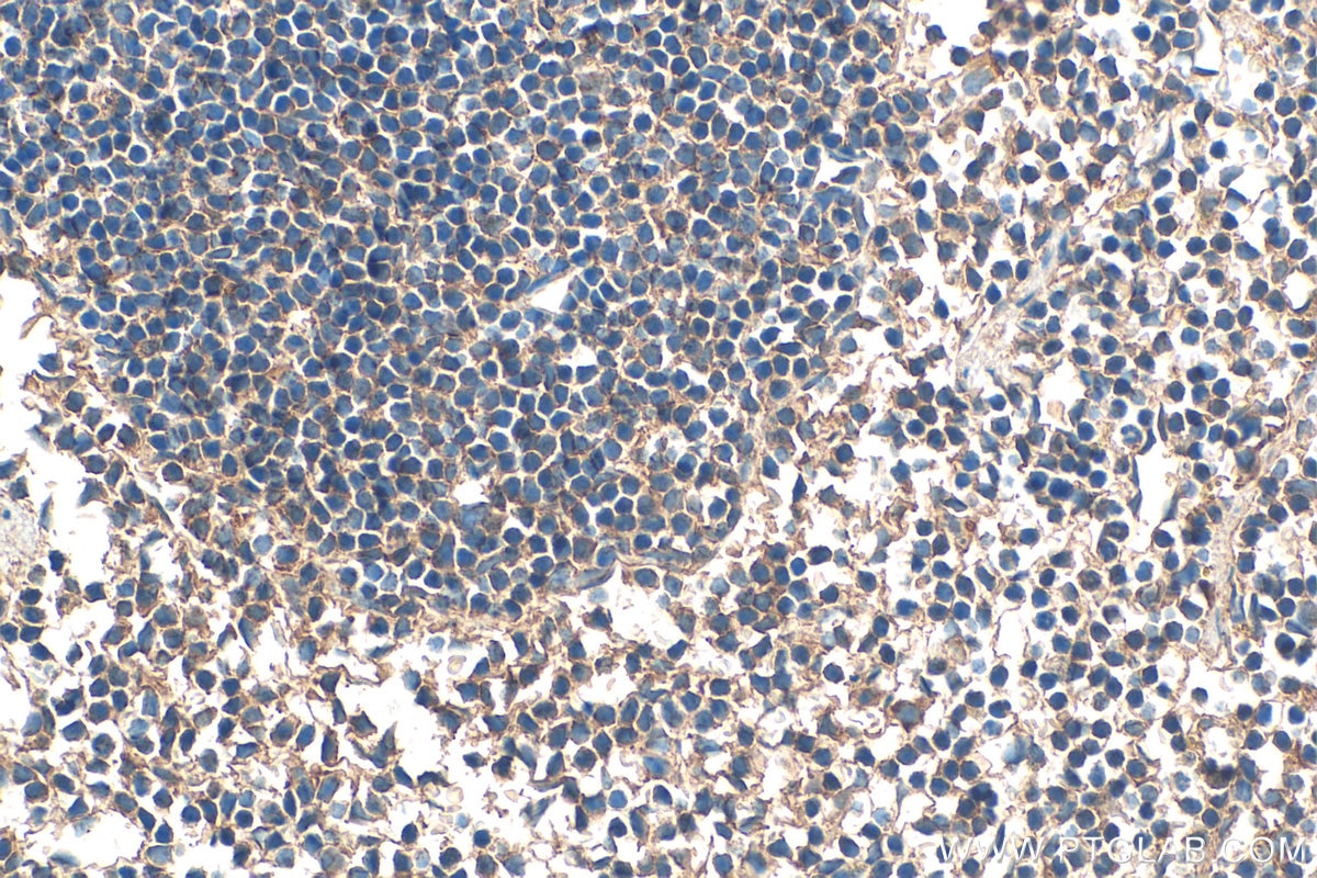 Immunohistochemical analysis of paraffin-embedded mouse spleen tissue slide using 17642-1-AP (C7 antibody) at dilution of 1:200 (under 40x lens). Heat mediated antigen retrieval with Tris-EDTA buffer (pH 9.0). Immunohistochemistry (IHC) staining of mouse spleen tissue using C7 Polyclonal antibody (17642-1-AP)