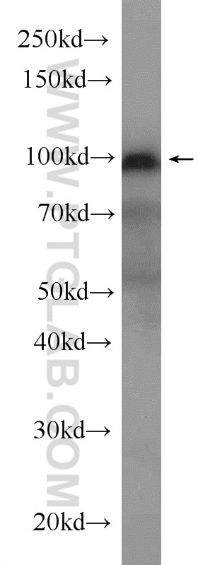 WB analysis of human blood using 17642-1-AP