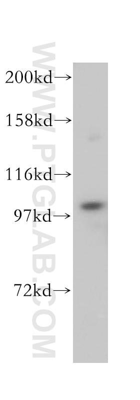 Western Blot (WB) analysis of mouse thymus tissue using C7 Polyclonal antibody (17642-1-AP)