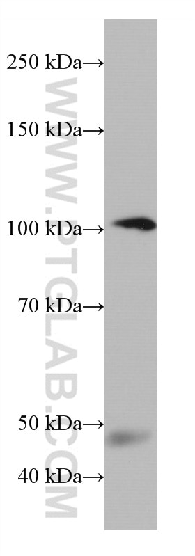 Western Blot (WB) analysis of human plasma using C7 Monoclonal antibody (66908-1-Ig)