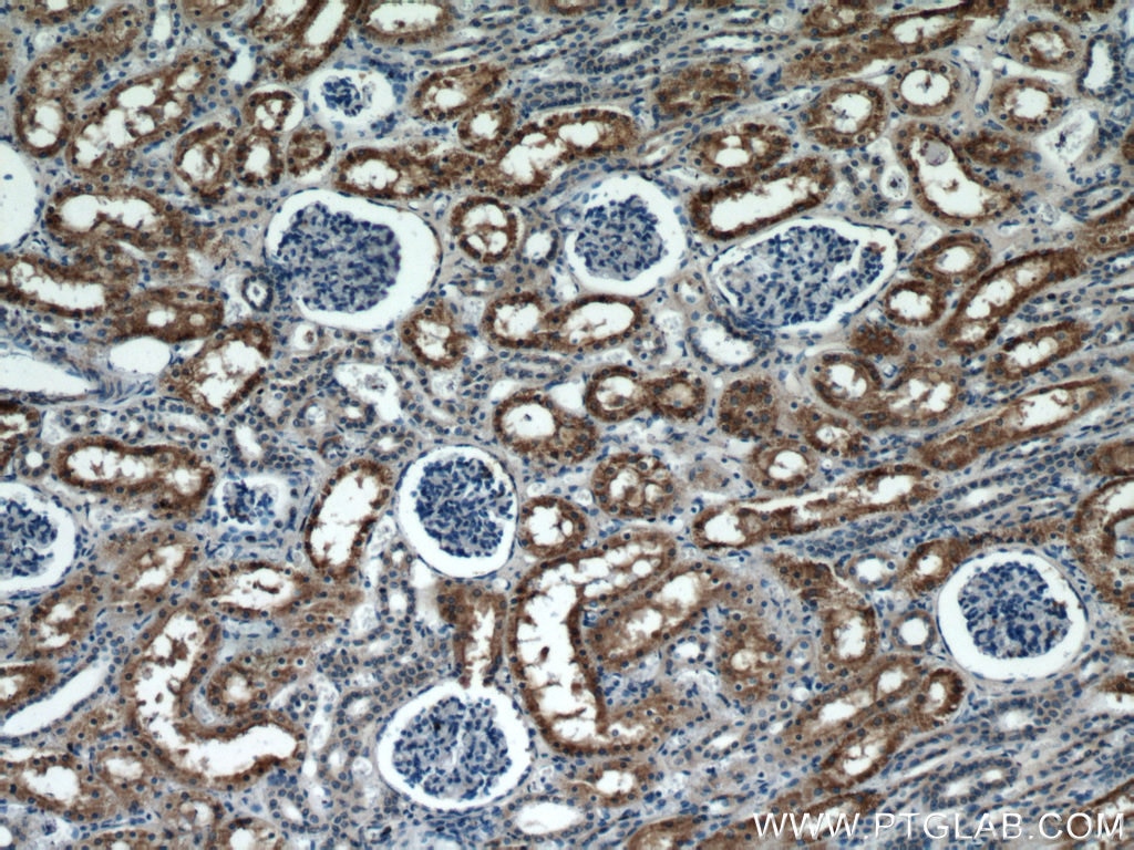 Immunohistochemistry (IHC) staining of human kidney tissue using C7orf10 Polyclonal antibody (21589-1-AP)