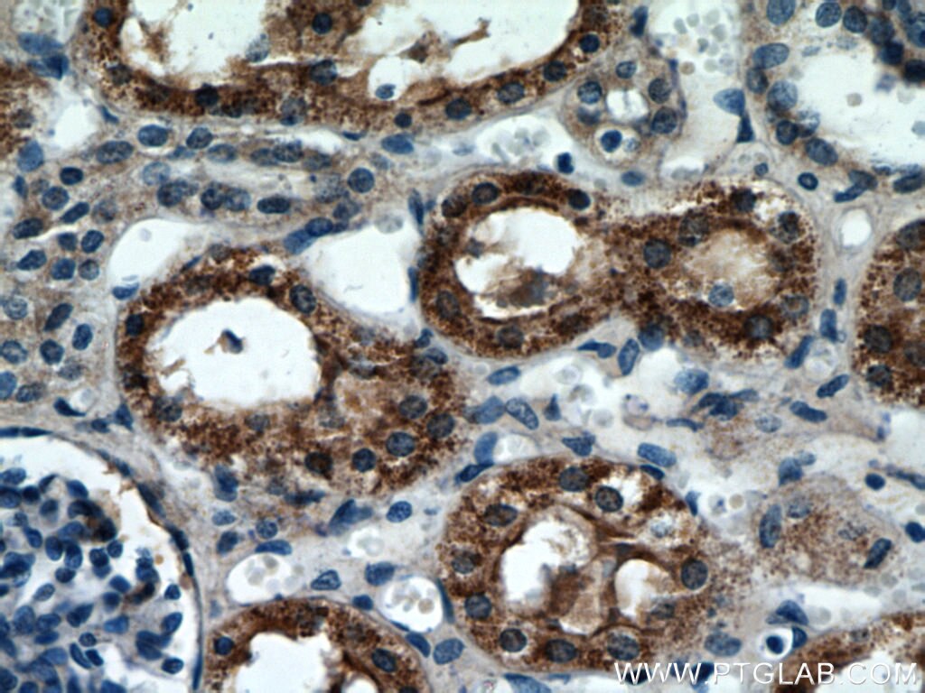 Immunohistochemistry (IHC) staining of human kidney tissue using C7orf10 Polyclonal antibody (21589-1-AP)