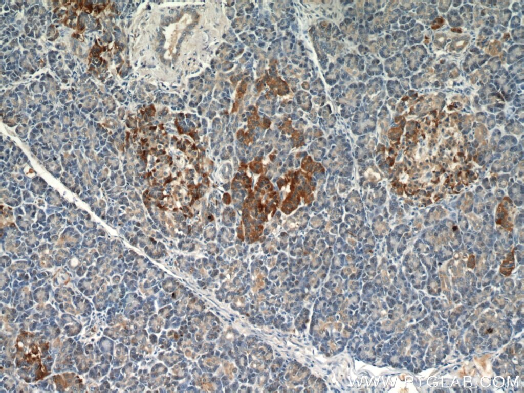 Immunohistochemistry (IHC) staining of human pancreas tissue using C7orf10 Polyclonal antibody (21589-1-AP)