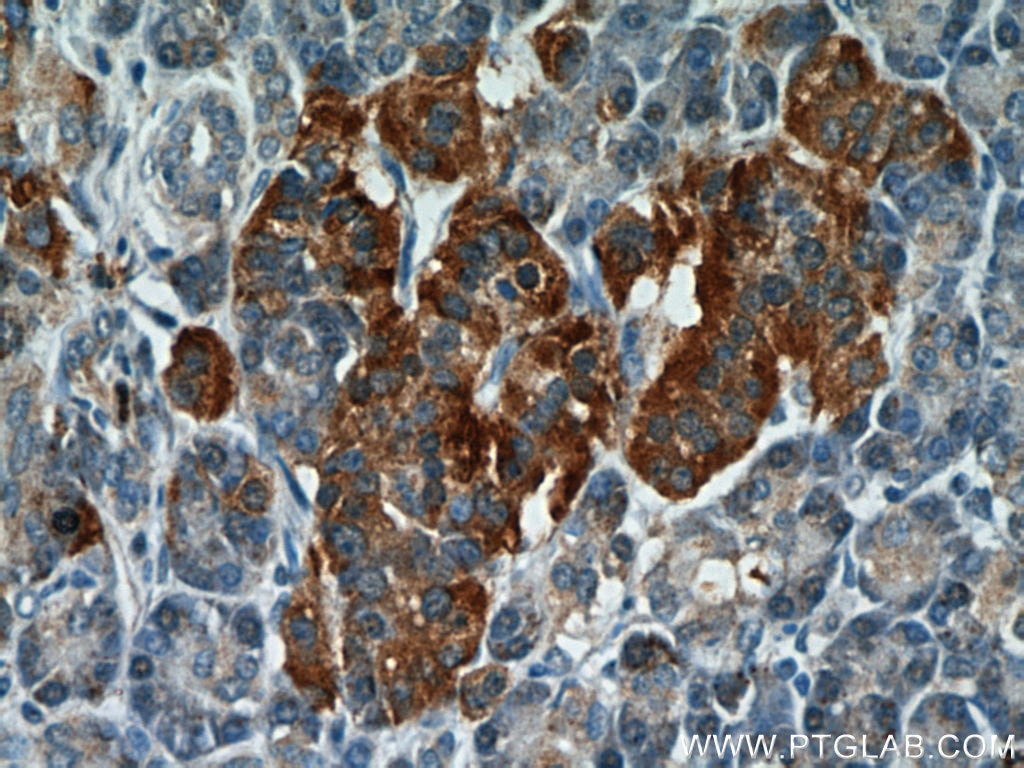 Immunohistochemistry (IHC) staining of human pancreas tissue using C7orf10 Polyclonal antibody (21589-1-AP)