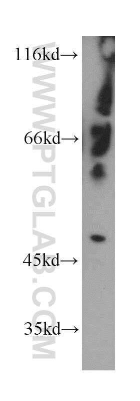 Western Blot (WB) analysis of mouse pancreas tissue using C7orf10 Polyclonal antibody (21589-1-AP)