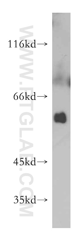 Western Blot (WB) analysis of mouse skeletal muscle tissue using C7orf10 Polyclonal antibody (21589-1-AP)