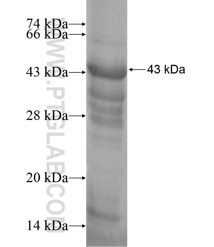 C7orf10 fusion protein Ag17058 SDS-PAGE C7orf10 fusion protein Ag17058 SDS-PAGE