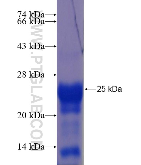 C7orf11 fusion protein Ag22094 SDS-PAGE