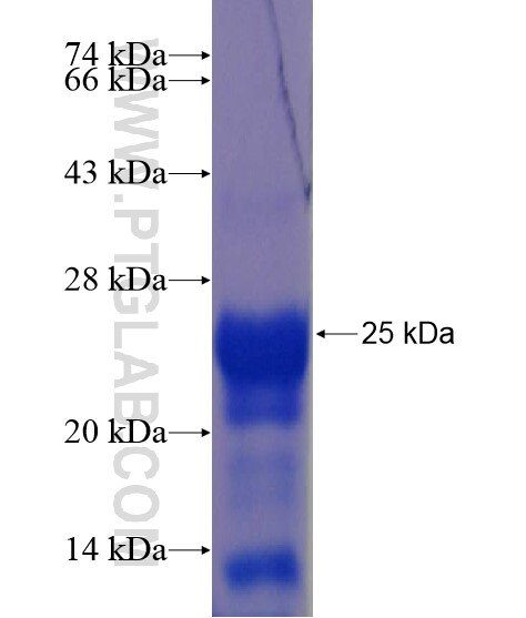 C7orf11 fusion protein Ag22094 SDS-PAGE