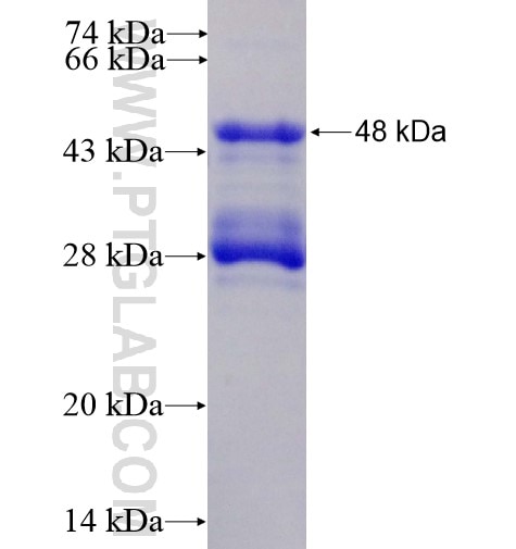 C7orf16 fusion protein Ag15187 SDS-PAGE