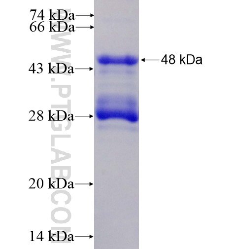 C7orf16 fusion protein Ag15187 SDS-PAGE