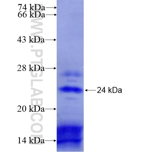 C7orf16 fusion protein Ag15620 SDS-PAGE