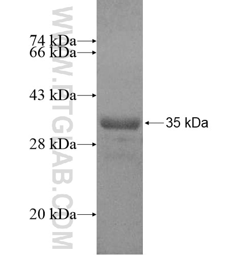 C7orf23 fusion protein Ag14979 SDS-PAGE