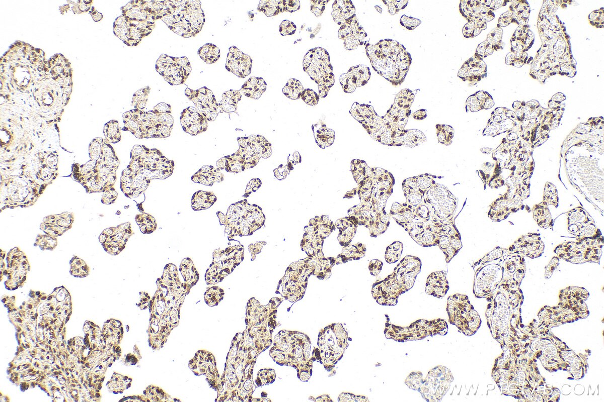 Immunohistochemistry (IHC) staining of human placenta tissue using C7orf27 Polyclonal antibody (31921-1-AP)