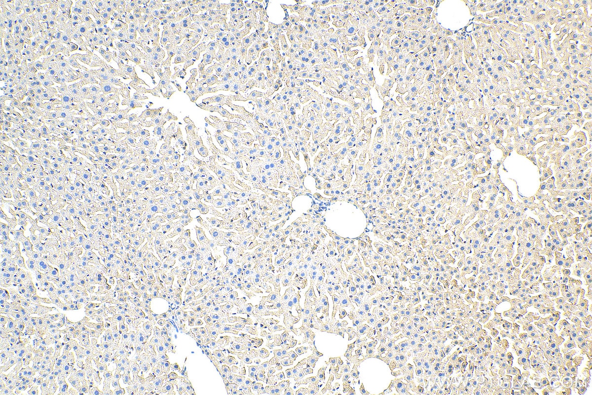 Immunohistochemistry (IHC) staining of mouse liver tissue using CCZ1 Polyclonal antibody (22159-1-AP)