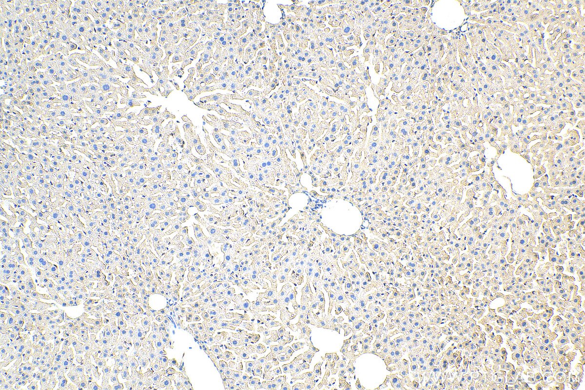 IHC staining of mouse liver using 22159-1-AP