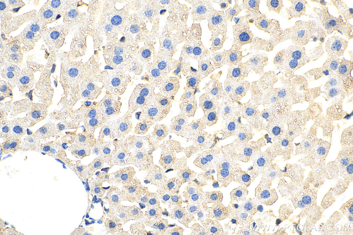 Immunohistochemistry (IHC) staining of mouse liver tissue using CCZ1 Polyclonal antibody (22159-1-AP)