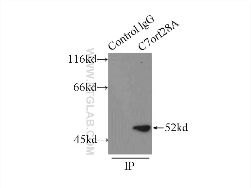 Immunoprecipitation (IP) experiment of NIH/3T3 cells using CCZ1 Polyclonal antibody (22159-1-AP)
