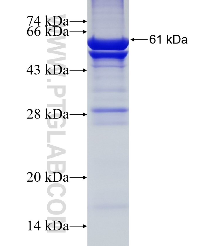 C7orf28A fusion protein Ag17804 SDS-PAGE