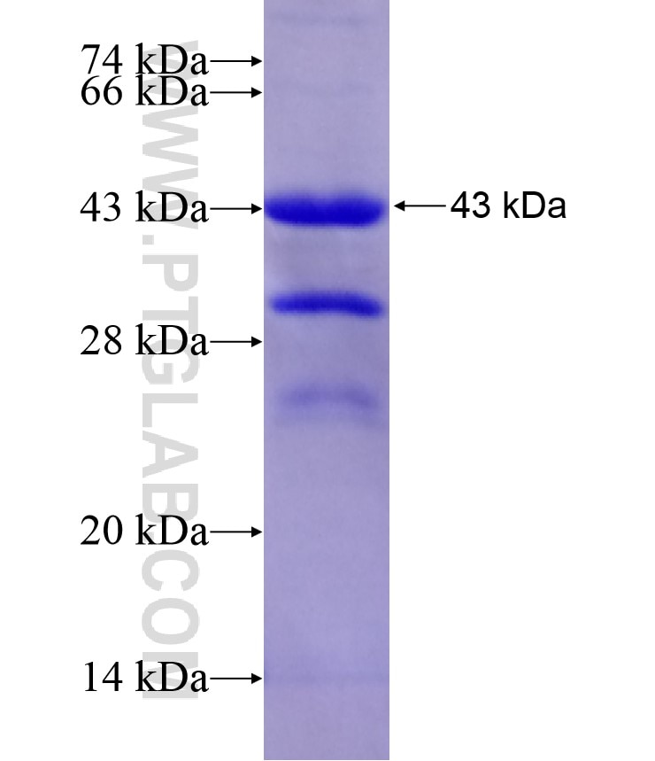 C7orf28A fusion protein Ag17890 SDS-PAGE