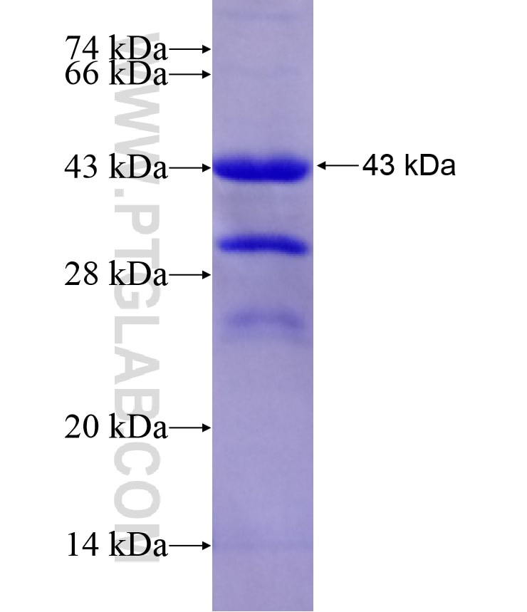 C7orf28A fusion protein Ag17890 SDS-PAGE C7orf28A fusion protein Ag17890 SDS-PAGE