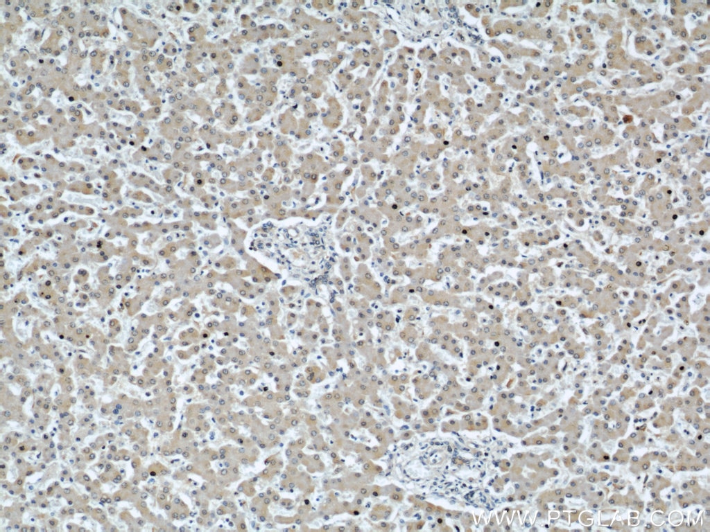 Immunohistochemistry (IHC) staining of human liver tissue using C7orf30 Polyclonal antibody (22838-1-AP)