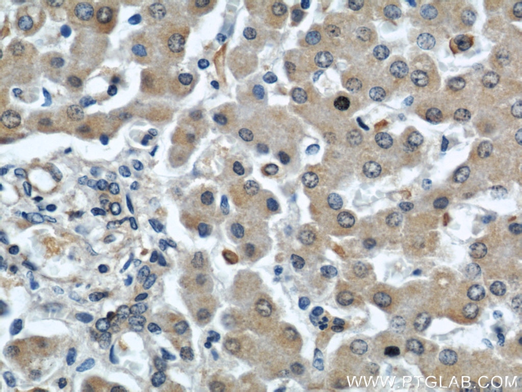 Immunohistochemistry (IHC) staining of human liver tissue using C7orf30 Polyclonal antibody (22838-1-AP)
