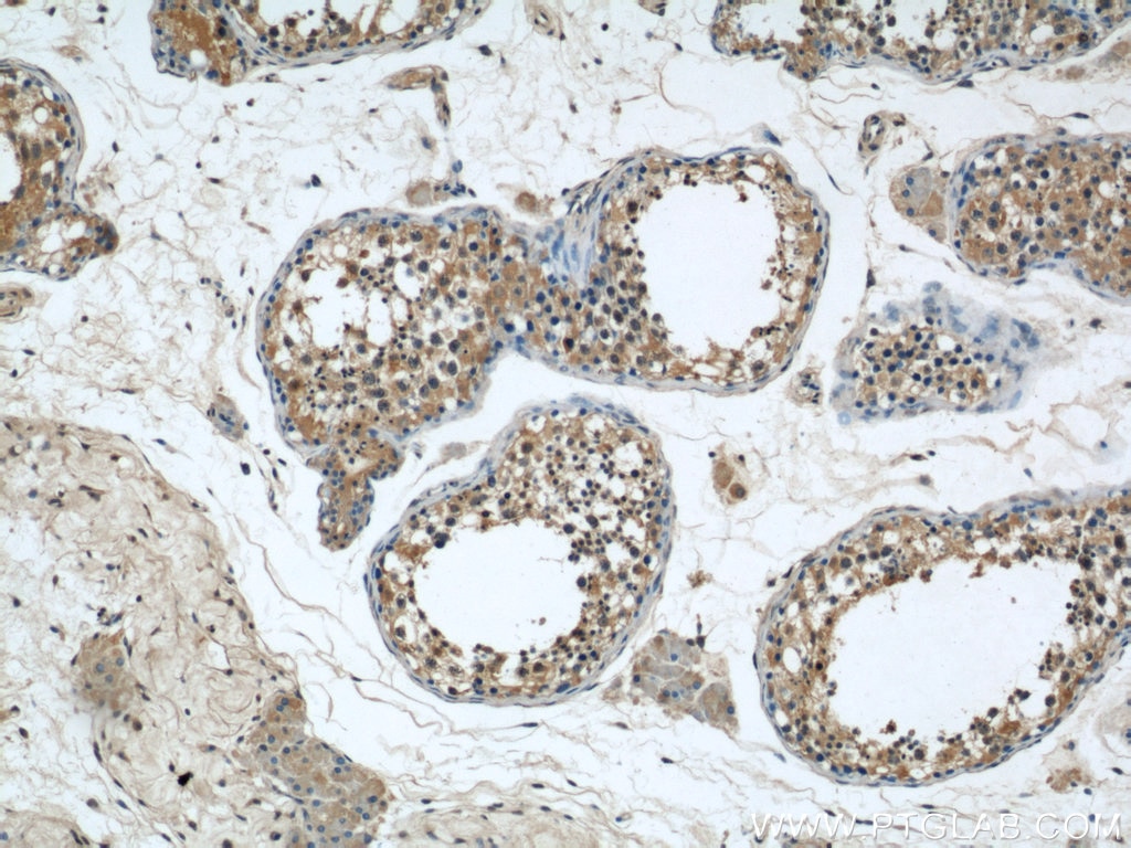 Immunohistochemistry (IHC) staining of human testis tissue using C7orf30 Polyclonal antibody (22838-1-AP)