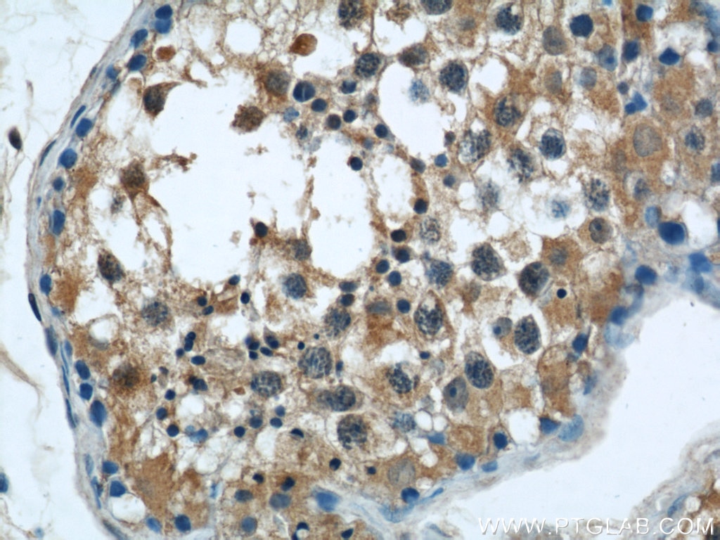Immunohistochemistry (IHC) staining of human testis tissue using C7orf30 Polyclonal antibody (22838-1-AP)