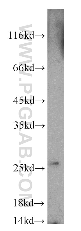 WB analysis of HeLa using 22838-1-AP