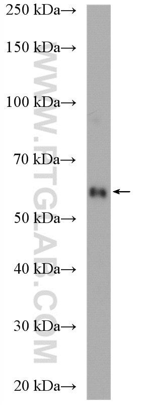 WB analysis of rat testis using 24354-1-AP