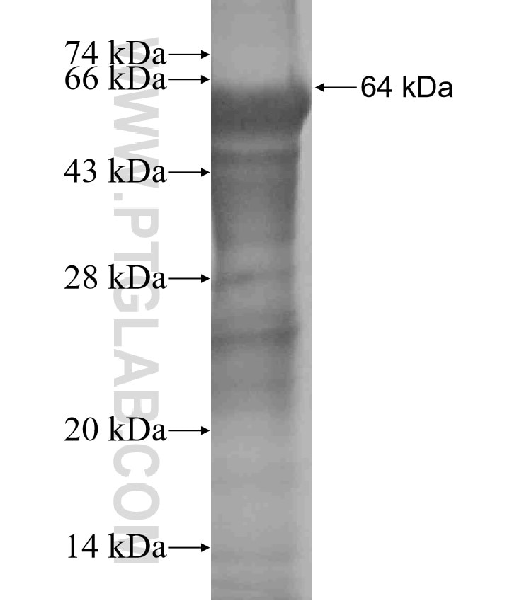 C7orf31 fusion protein Ag19530 SDS-PAGE