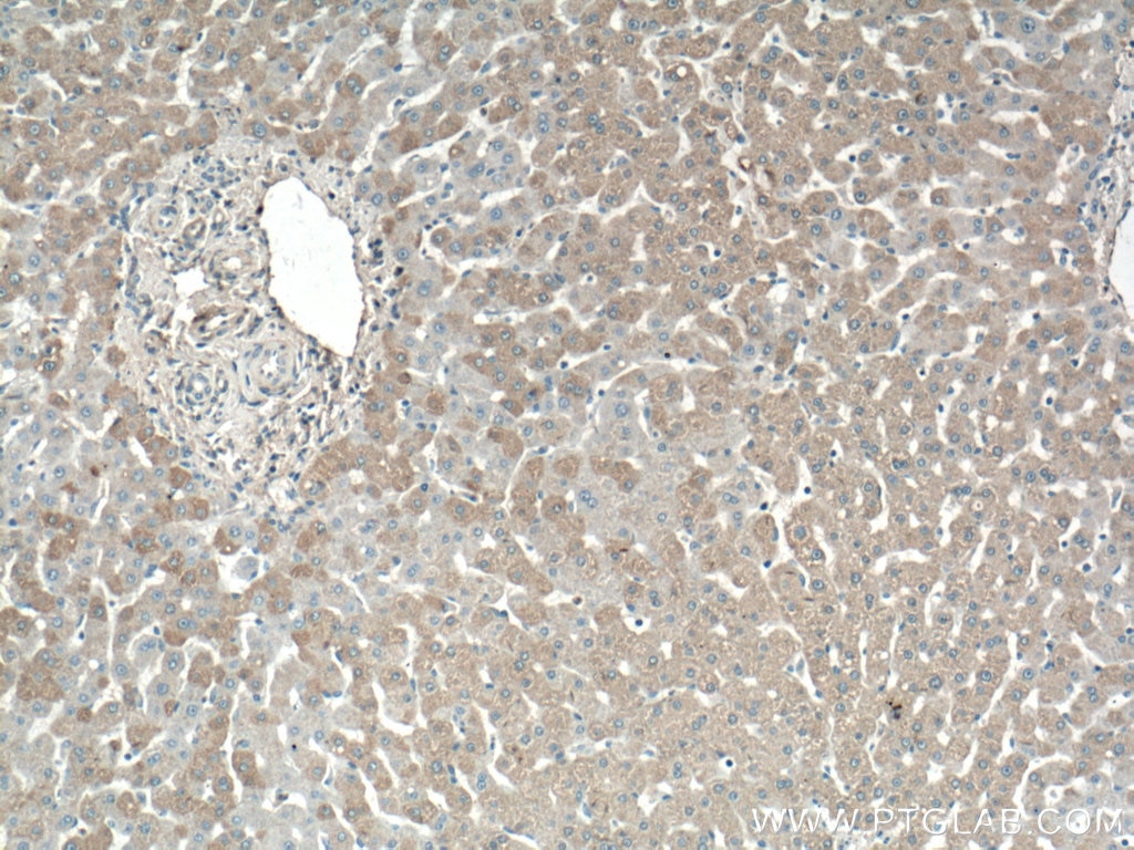 Immunohistochemistry (IHC) staining of human liver tissue using C7orf43 Polyclonal antibody (27790-1-AP)