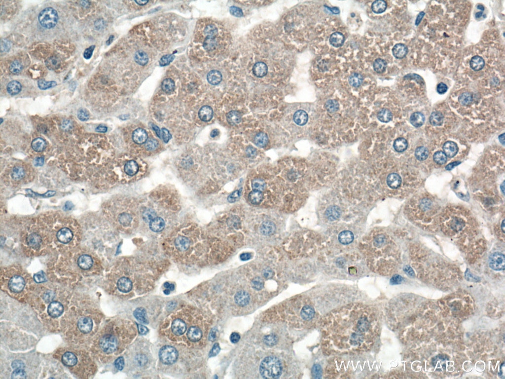 Immunohistochemistry (IHC) staining of human liver tissue using C7orf43 Polyclonal antibody (27790-1-AP)