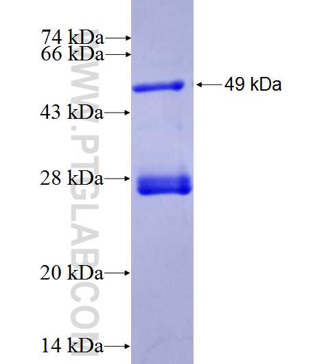 C7orf43 fusion protein Ag27149 SDS-PAGE