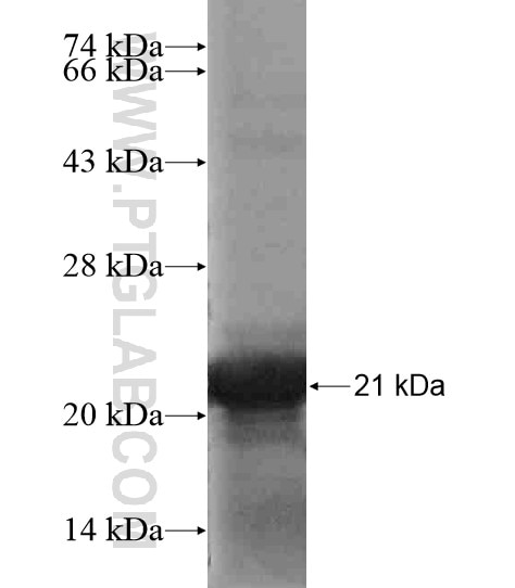 C7orf44 fusion protein Ag19411 SDS-PAGE