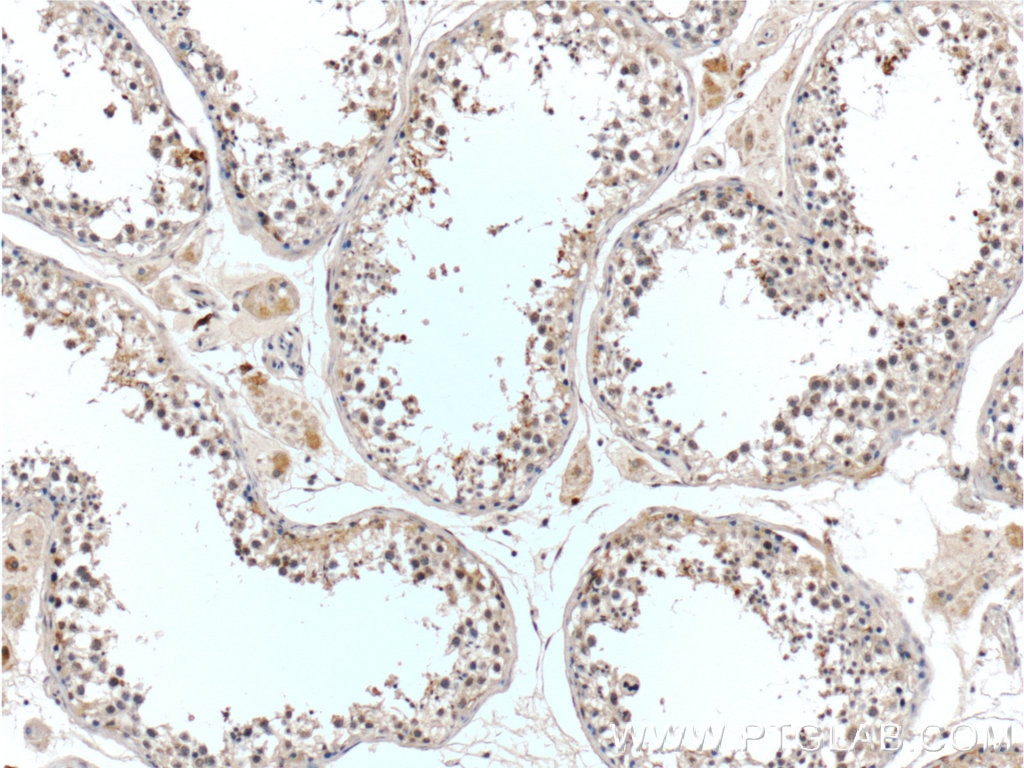 Immunohistochemistry (IHC) staining of human testis tissue using C7orf47 Polyclonal antibody (24214-1-AP)