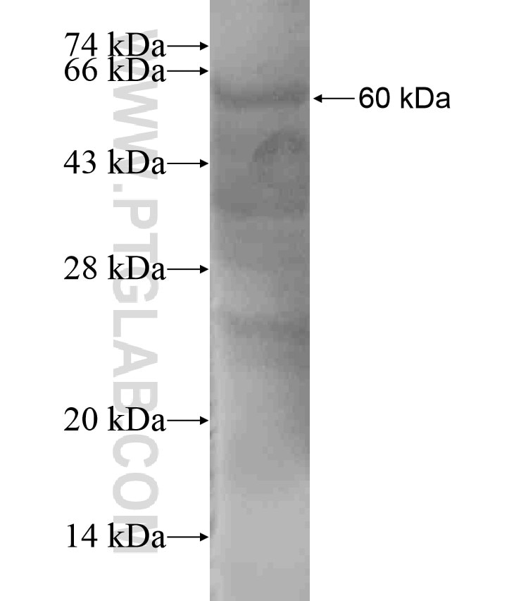 C7orf47 fusion protein Ag18327 SDS-PAGE C7orf47 fusion protein Ag18327 SDS-PAGE