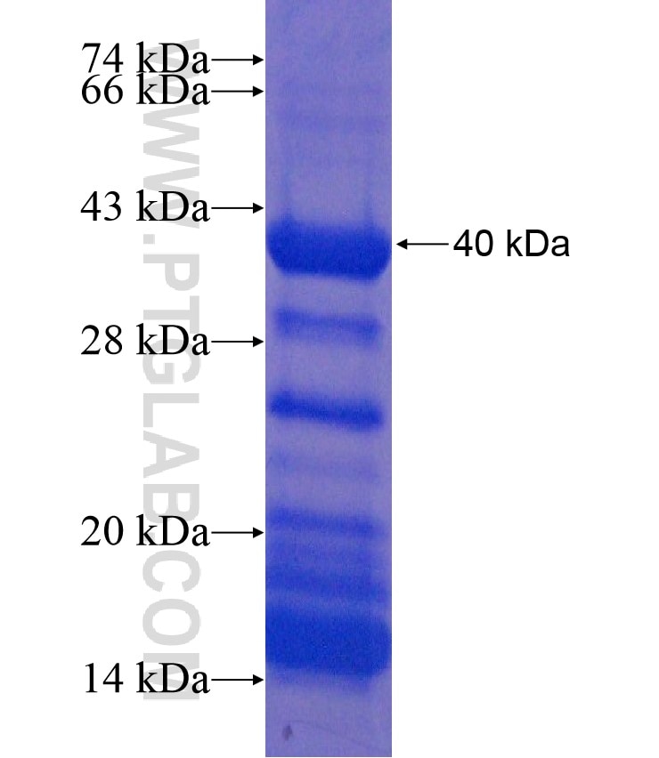 C7orf47 fusion protein Ag18340 SDS-PAGE