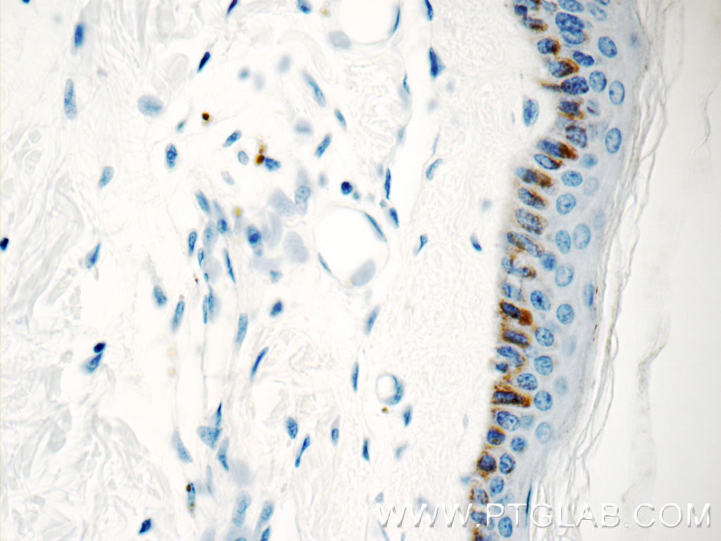 IHC staining of human skin using 15076-1-AP