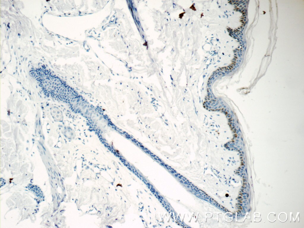 Immunohistochemistry (IHC) staining of human skin tissue using C7orf49 Polyclonal antibody (15076-1-AP)