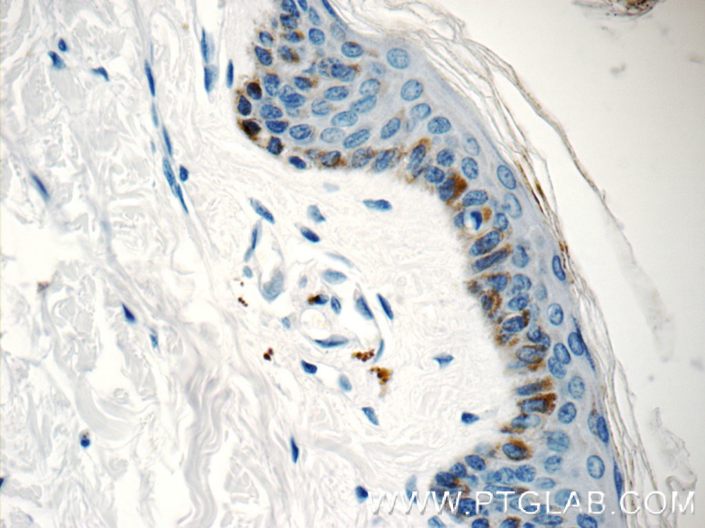 IHC staining of human skin using 15076-1-AP