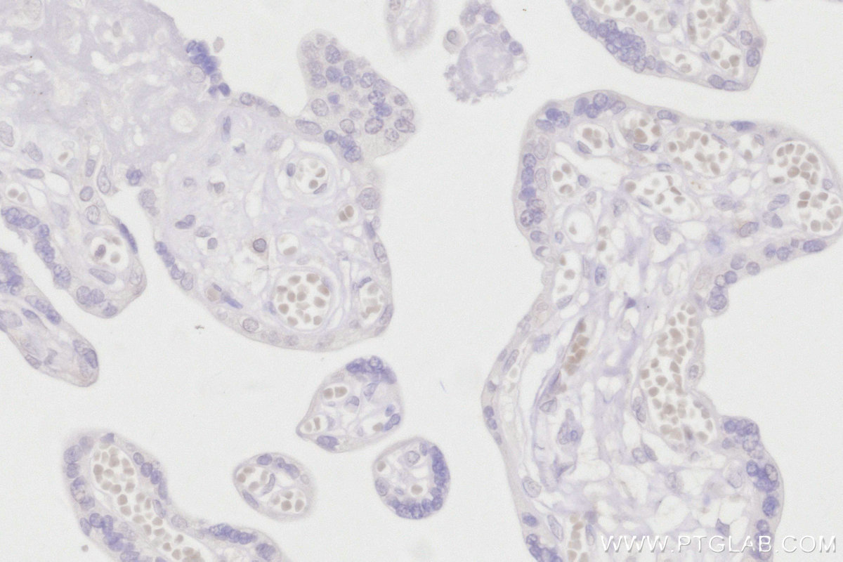 Immunohistochemical analysis of paraffin-embedded human placenta tissue slide using 15076-1-AP (C7orf49 antibody) at dilution of 1:200 (under 40x lens). Heat mediated antigen retrieval with Tris-EDTA buffer (pH 9.0). Immunohistochemistry (IHC) staining of human placenta tissue using C7orf49 Polyclonal antibody (15076-1-AP)