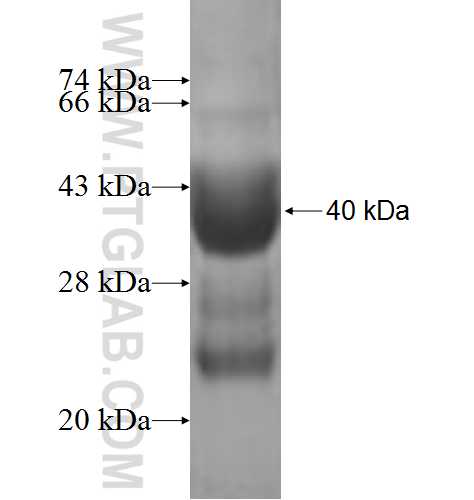 C7orf49 fusion protein Ag7148 SDS-PAGE