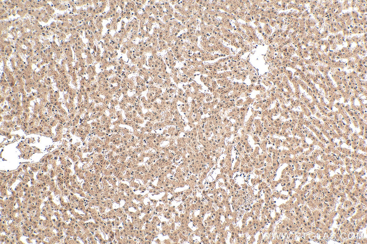 Immunohistochemical analysis of paraffin-embedded human liver tissue slide using 20797-1-AP (C7orf50 antibody) at dilution of 1:200 (under 10x lens). Heat mediated antigen retrieval with Tris-EDTA buffer (pH 9.0). Immunohistochemistry (IHC) staining of human liver tissue using C7orf50 Polyclonal antibody (20797-1-AP)