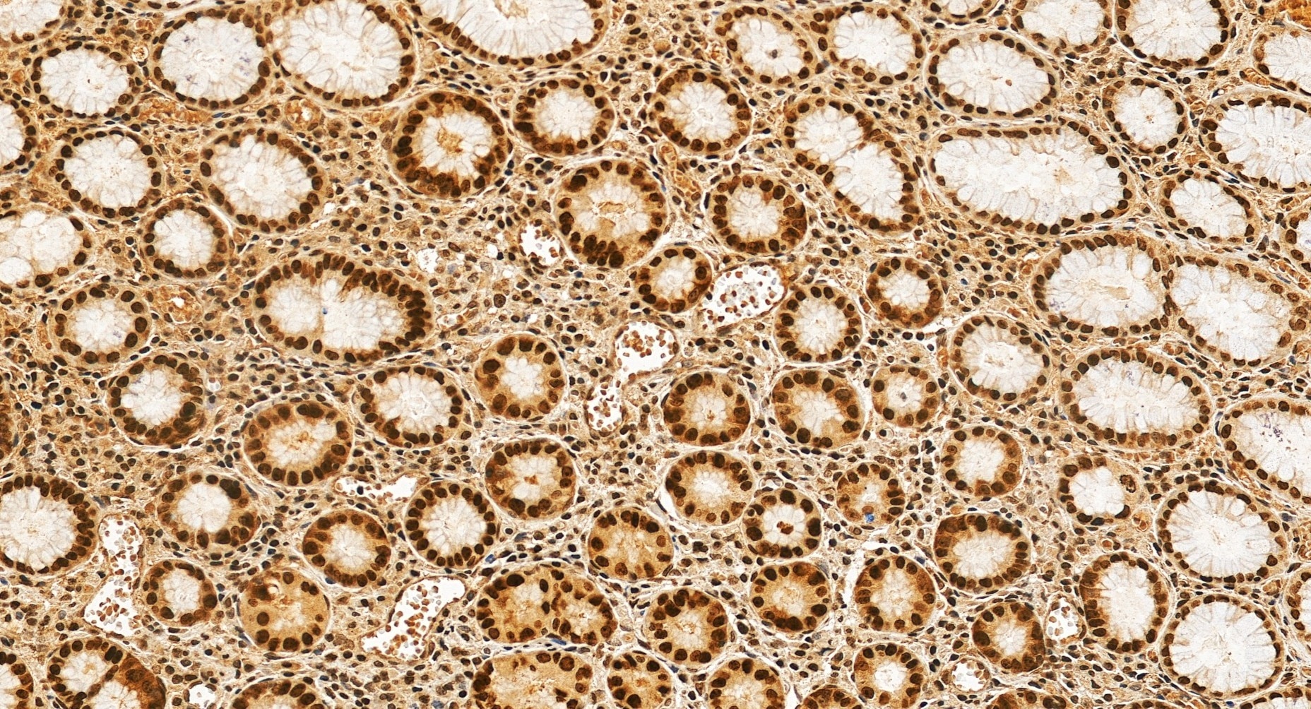 Immunohistochemical analysis of paraffin-embedded human stomach tissue slide using 68494-1-Ig (C7orf50 antibody) at dilution of 1:400 (under 20x lens). Heat mediated antigen retrieval with Tris-EDTA buffer (pH 9.0). Immunohistochemistry (IHC) staining of human stomach tissue using C7orf50 Monoclonal antibody (68494-1-Ig)