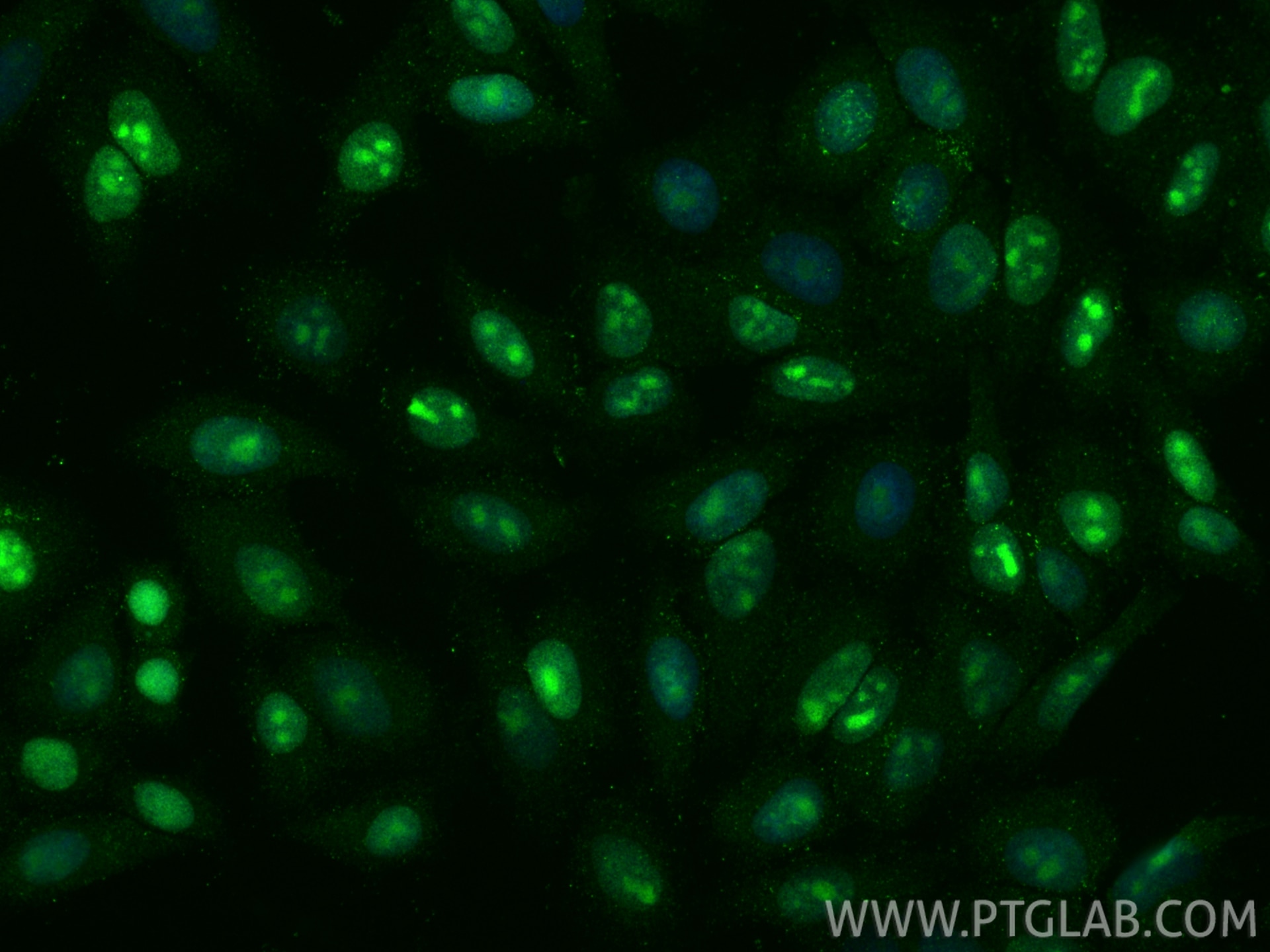 Immunofluorescent analysis of (4% PFA) fixed HepG2 cells using C7orf50 antibody (68494-1-Ig, Clone: 2A3G5 ) at dilution of 1:1200 and CoraLite®488-Conjugated Goat Anti-Mouse IgG(H+L) (SA00013-1). Immunofluorescence (IF) / fluorescent staining of HepG2 cells using C7orf50 Monoclonal antibody (68494-1-Ig)
