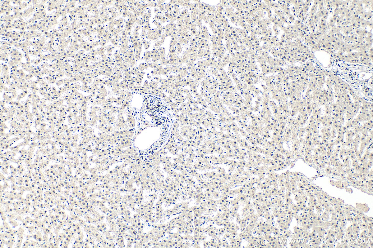 Immunohistochemical analysis of paraffin-embedded human liver tissue slide using 68494-1-Ig (C7orf50 antibody) at dilution of 1:400 (under 10x lens). Heat mediated antigen retrieval with Tris-EDTA buffer (pH 9.0). Immunohistochemistry (IHC) staining of human liver tissue using C7orf50 Monoclonal antibody (68494-1-Ig)