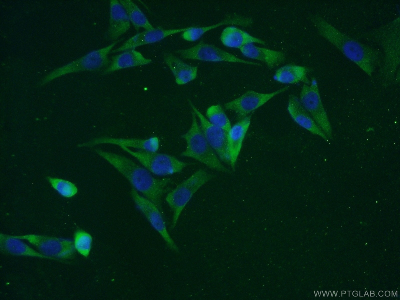 Immunofluorescence (IF) / fluorescent staining of A375 cells using C7orf58 Polyclonal antibody (20924-1-AP)
